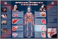 Электрифицированный стенд "Вредные привычки: алкоголизм" - «globural.ru» - Тверь